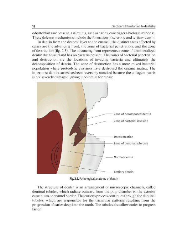 Дополнительное изображение книги «Preclinical course of dentistry: textbook : in 5 parts. Part II. Cariesology and direct restoration. (книга на англ. яз)»