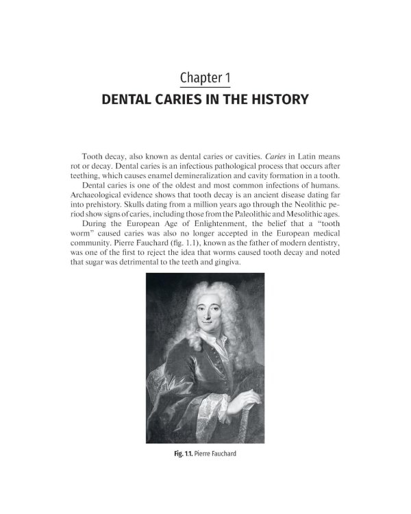 Дополнительное изображение книги «Preclinical course of dentistry: textbook : in 5 parts. Part II. Cariesology and direct restoration. (книга на англ. яз)»