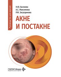 Акне и постакне: руководство для врачей