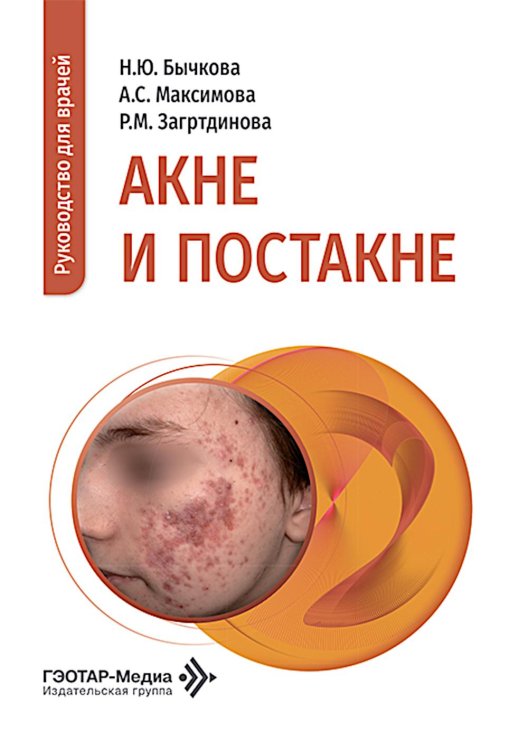 Обложка книги «Акне и постакне: руководство для врачей» — Бычкова Наталья Юрьевна;Максимова Алена Станиславовна;Загртдинова Ризида Миннесагитовна, ISBN 9785970499597