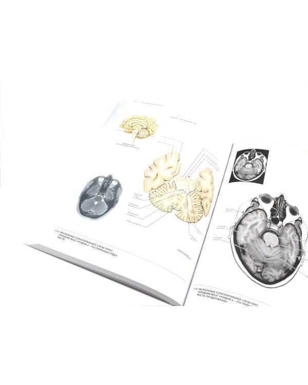 Неврология. Атлас с иллюстрациями Неттера; Атлас-раскраска с рисунками Неттера (комплект из 2-х книг)