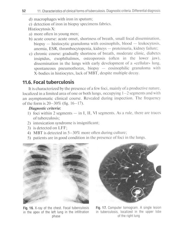 Diagnosis and prevention of tuberculosis in general medical practice = Диагностика и профилактика туберкулеза в общей врачебной практике