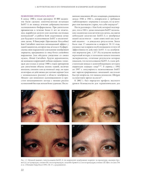 Ботулинические токсины в клинической эстетической практике. 2-е изд