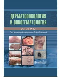 Дерматоонкология и онкогематология. Атлас