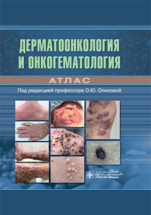 Дерматоонкология и онкогематология. Атлас Дерматоонкология и онкогематология. Атлас