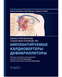 Имплантируемые кардиовертеры-дефибрилляторы. Иллюстрированное пошаговое руководство