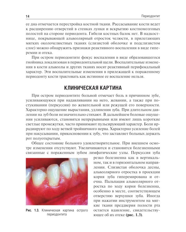 Одонтогенные воспалительные заболевания полости рта: Учебное пособие. 2-е изд., испр. и доп