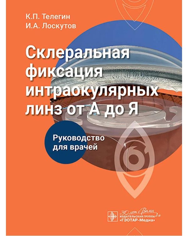 Склеральная фиксация интраокулярных линз от А до Я: руководство для врачей