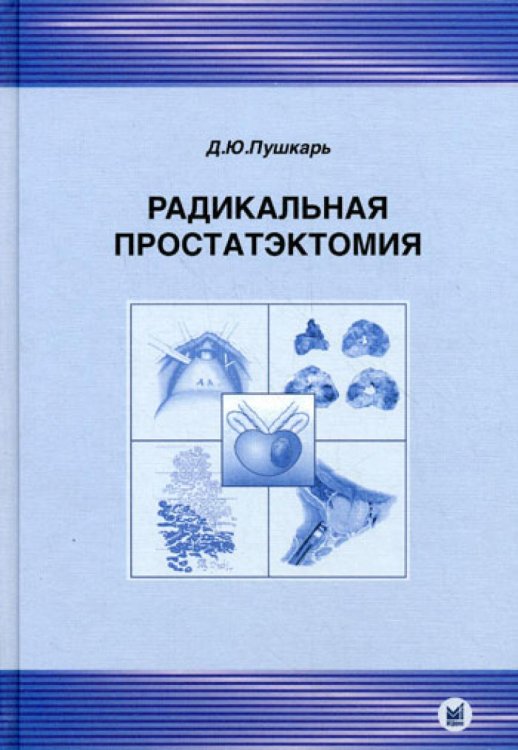 Радикальная простатэктомия. 3-е изд., без изм