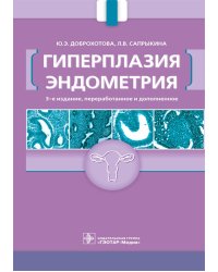 Гиперплазия эндометрия. 3-е изд., перераб. и доп