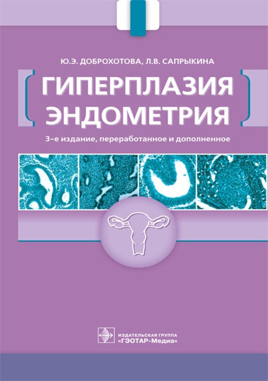 Гиперплазия эндометрия. 3-е изд., перераб. и доп