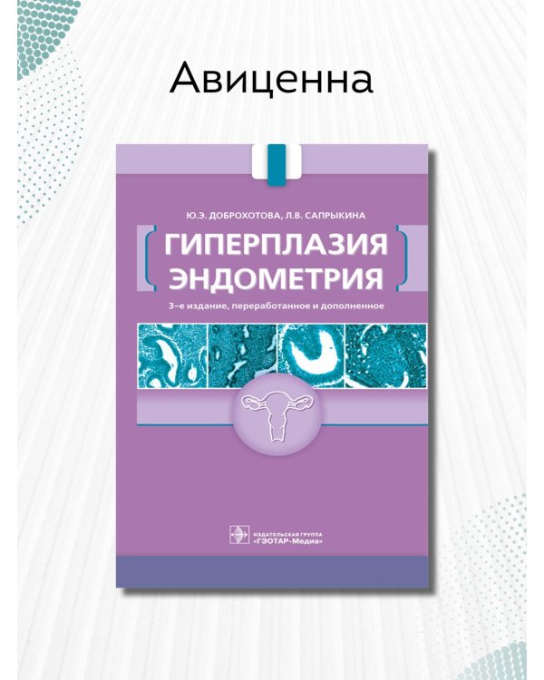 Гиперплазия эндометрия