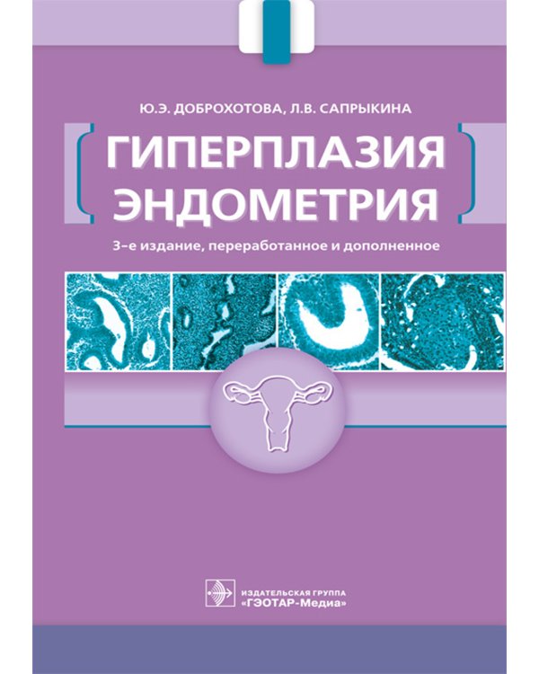 Гиперплазия эндометрия. 3-е изд., перераб. и доп