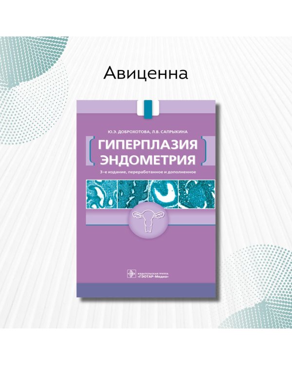 Гиперплазия эндометрия