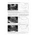 Практическая ультразвуковая диагностика. Руководство для врачей. В 5 т. Т. 3. Ультразвуковая диагностика заболевания женских половых органов Практическая ультразвуковая диагностика. Руководство для врачей. В 5 т. Т. 3. Ультразвуковая диагностика заболевания женских половых органов