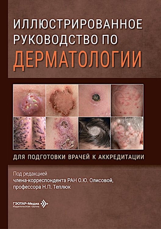 Обложка книги «Иллюстрированное руководство по дерматологии. Для подготовки врачей к аккредитации / под ред. О. Ю. Олисовой, Н. П. Теплюк. — Москва : ГЭОТАР-Медиа, 2» — None, ISBN 9785002820276