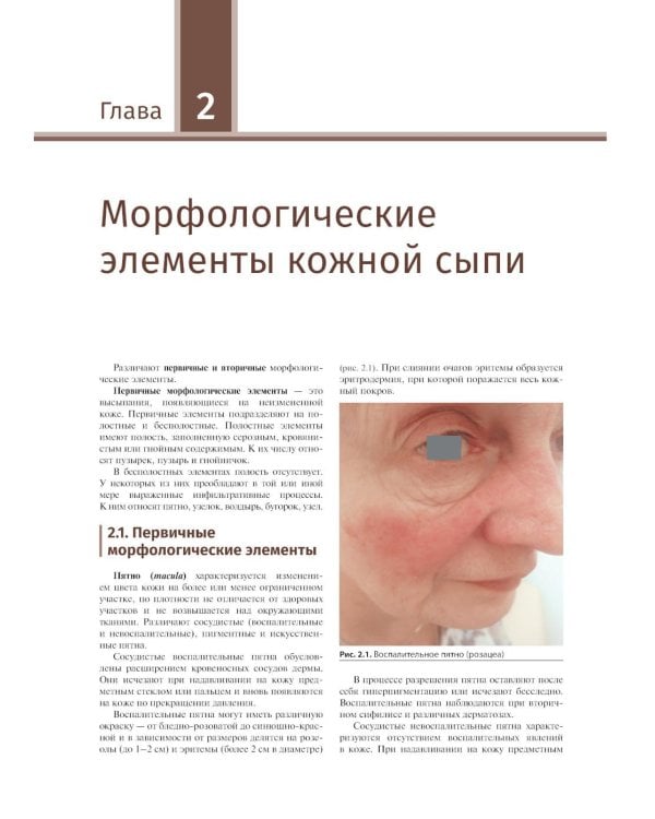 Дополнительное изображение книги «Иллюстрированное руководство по дерматологии. Для подготовки врачей к аккредитации / под ред. О. Ю. Олисовой, Н. П. Теплюк. — Москва : ГЭОТАР-Медиа, 2»