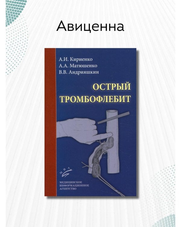 Острый тромбофлебит