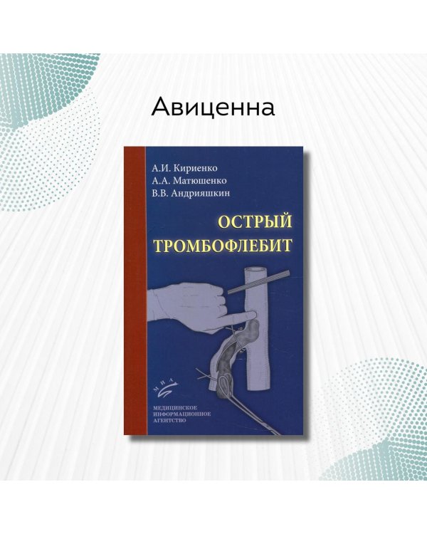 Острый тромбофлебит