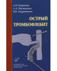 Острый тромбофлебит. 2-е изд., перераб и доп