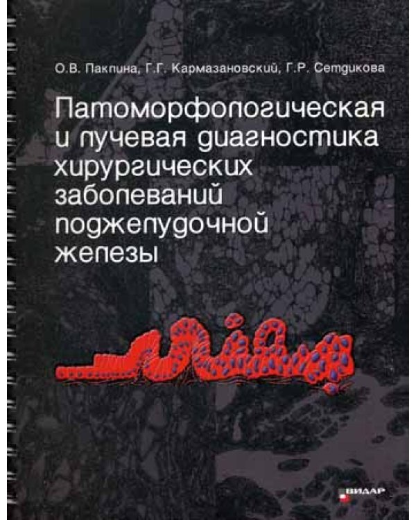 Патоморфологическая и лучевая диагностика хирургических заболеваний поджелудочной железы