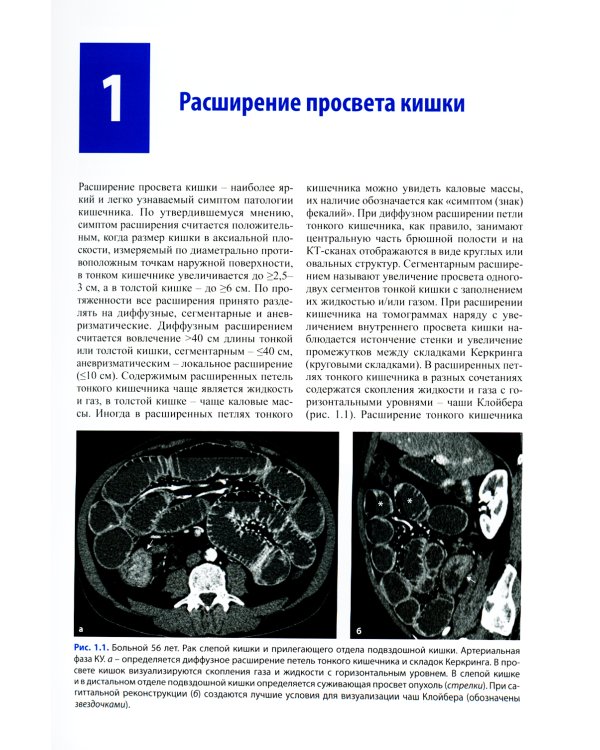 Компьютерная томография в диагностике заболеваний кишечника. 2-е изд
