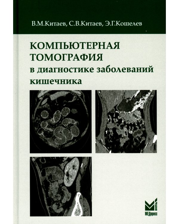 Компьютерная томография в диагностике заболеваний кишечника. 2-е изд