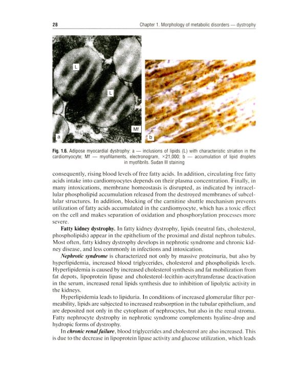 Дополнительное изображение книги «Pathological Anatomy = Патологическая анатомия: textbook. (книга на англ. яз)»