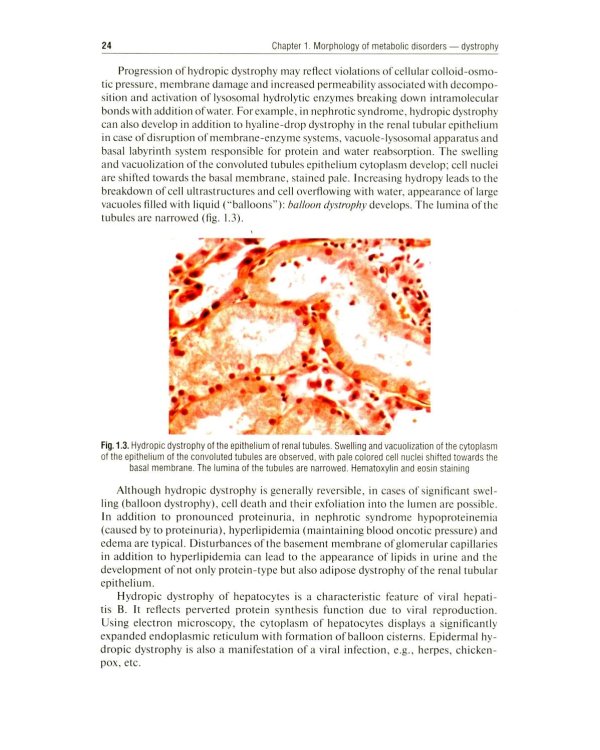 Дополнительное изображение книги «Pathological Anatomy = Патологическая анатомия: textbook. (книга на англ. яз)»
