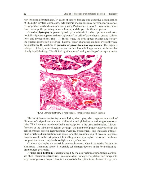 Дополнительное изображение книги «Pathological Anatomy = Патологическая анатомия: textbook. (книга на англ. яз)»