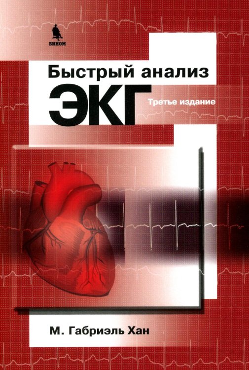 Быстрый анализ ЭКГ. 3-е изд Быстрый анализ ЭКГ. 3-е изд