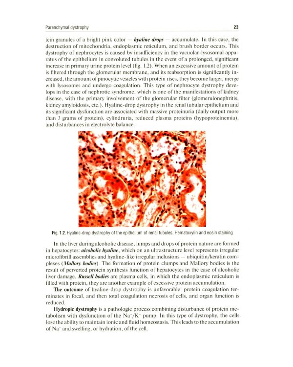 Дополнительное изображение книги «Pathological Anatomy = Патологическая анатомия: textbook. (книга на англ. яз)»