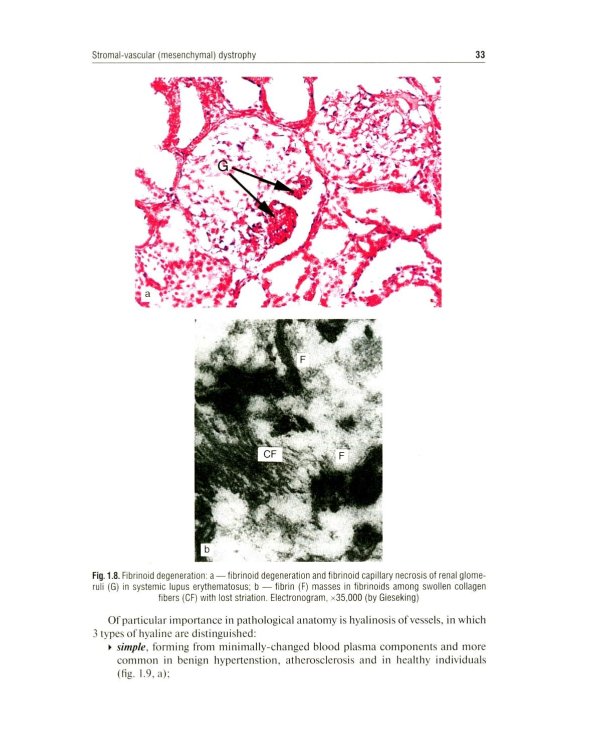 Дополнительное изображение книги «Pathological Anatomy = Патологическая анатомия: textbook. (книга на англ. яз)»