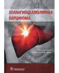 Холангиоцеллюлярная карцинома