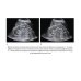 Дополнительное изображение книги «Клинические нормы. УЗИ почек и мочевыводящих путей. 2-е изд., перераб. и доп»