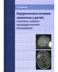 Хирургическое лечение эпилепсии у детей: показания, вопросы предхирургического обследования