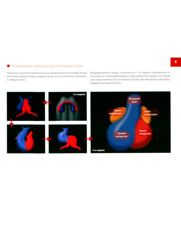 Атлас по УЗД в акушерстве. Нормальная ультразвуковая топографическая анатомия сердца плода: Практическое пособие для врачей