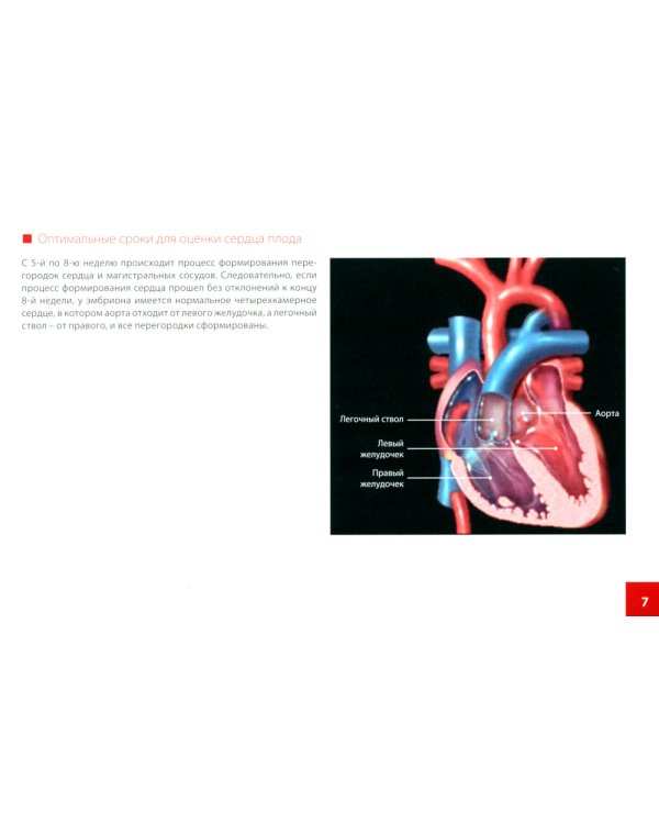 Атлас по УЗД в акушерстве. Нормальная ультразвуковая топографическая анатомия сердца плода: Практическое пособие для врачей