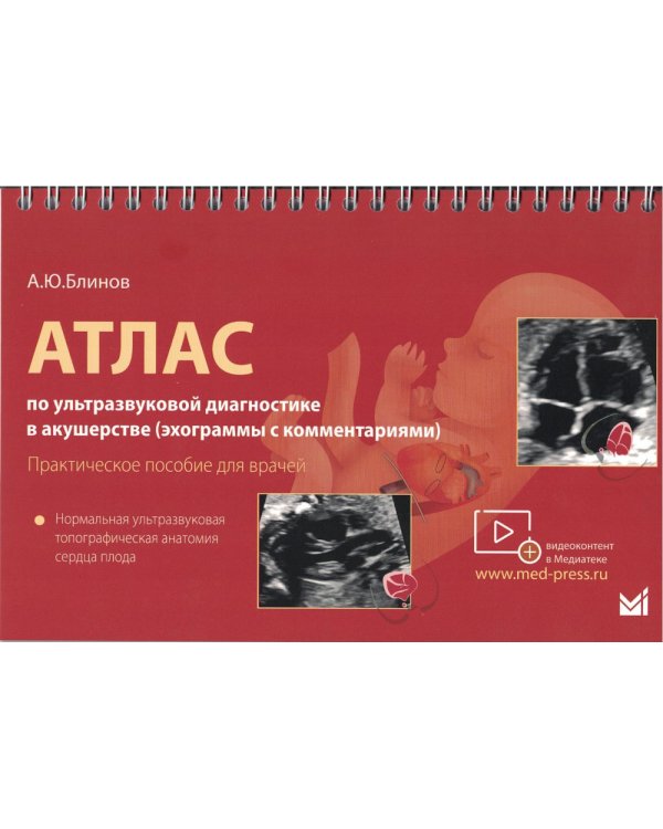 Атлас по УЗД в акушерстве. Нормальная ультразвуковая топографическая анатомия сердца плода: Практическое пособие для врачей