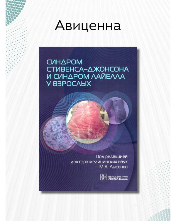 Дополнительное изображение книги «Синдром Стивенса-Джонсона и синдром Лайелла у взрослых»
