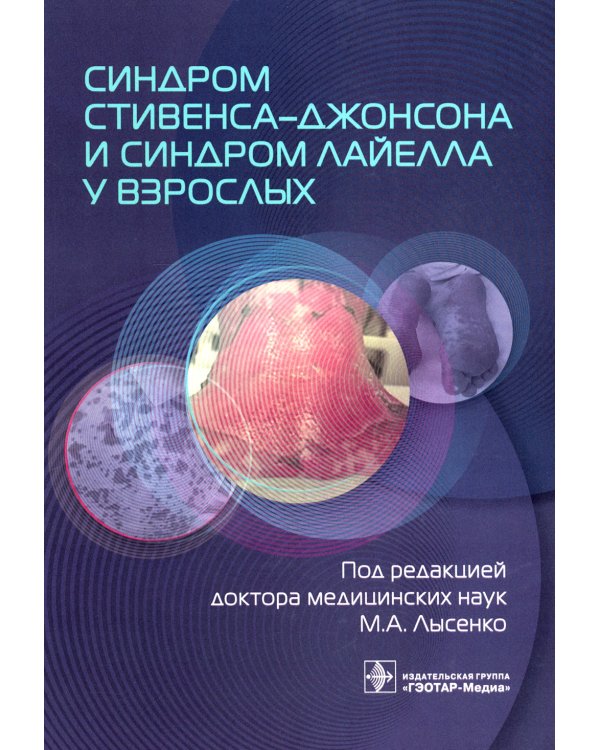 Дополнительное изображение книги «Синдром Стивенса-Джонсона и синдром Лайелла у взрослых»