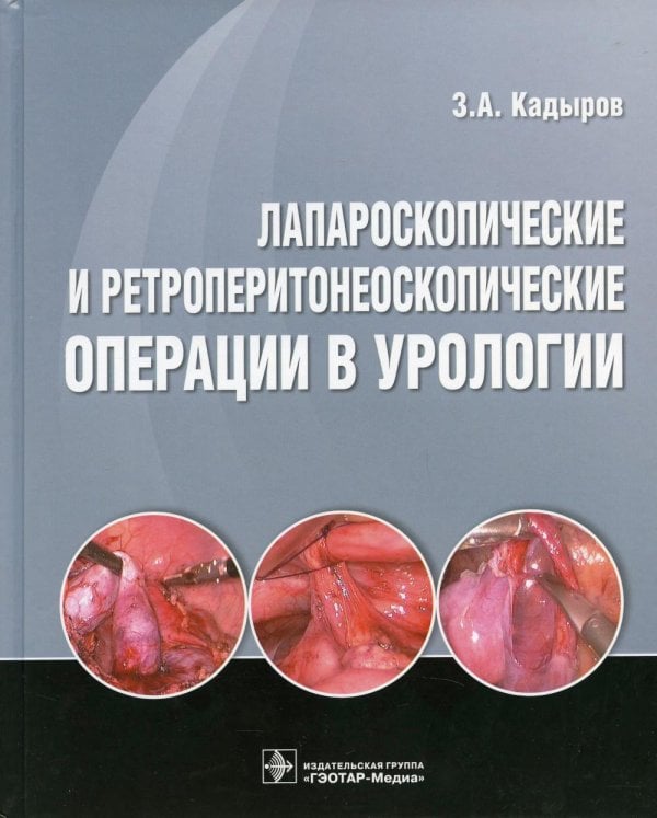Лапароскопические и ретроперитонеоскопические операции в урологии