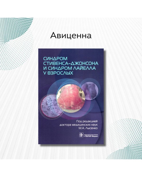 Дополнительное изображение книги «Синдром Стивенса-Джонсона и синдром Лайелла у взрослых»