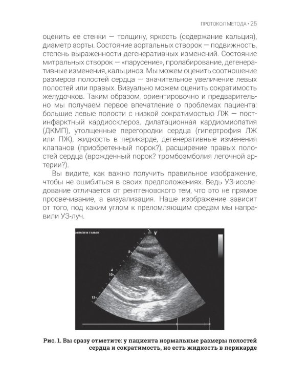 Эхокардиография для начинающих. 2-е изд., перераб. и доп