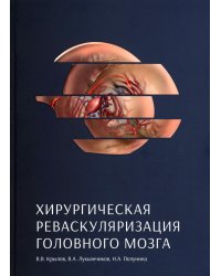 Хирургическая реваскуляризация головного мозга