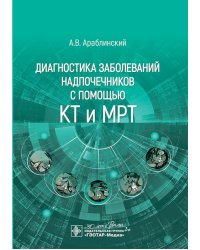 Диагностика заболеваний надпочечников с помощью КТ и МРТ