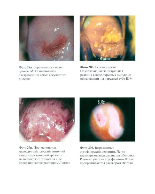 Практическая кольпоскопия: руководство для врачей. 6-е изд., перераб. и доп