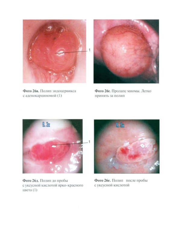 Практическая кольпоскопия: руководство для врачей. 6-е изд., перераб. и доп