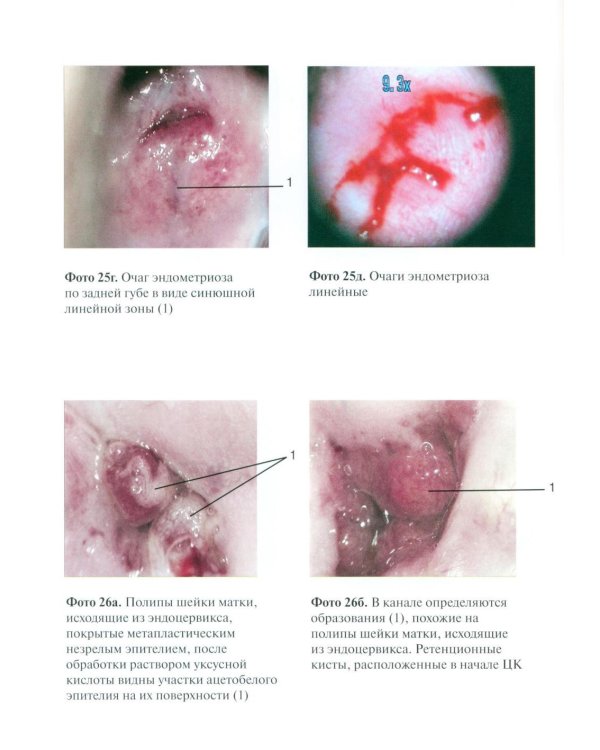 Практическая кольпоскопия: руководство для врачей. 6-е изд., перераб. и доп