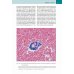 Биопсии эндометрия. Практическое руководство